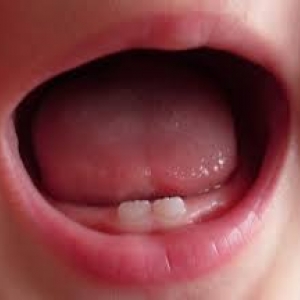 Млечни зъбки